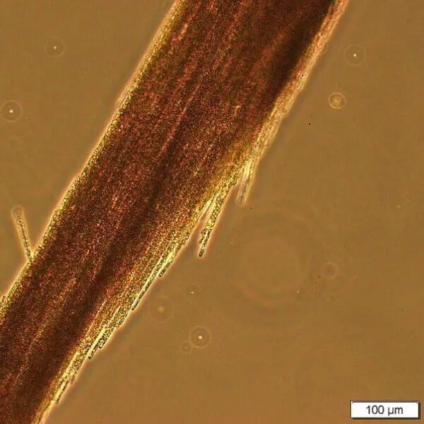 Brin d'algue Klamath Aphanizomenon Flos Aquae vue au microscope.