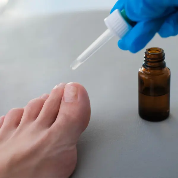 Traitement d'une mycose d'ongle de pied avec de l'extrait de pépins de pamplemousse.