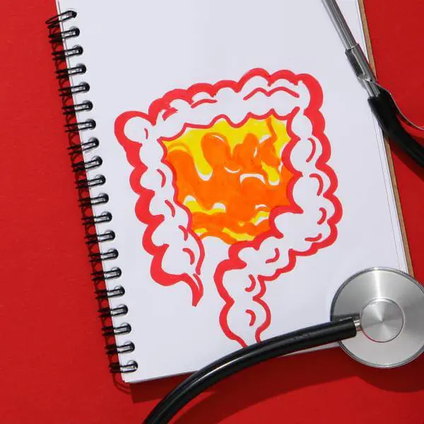 Dessin d'un intestin poreux enflammé avec un stéthoscope médical.