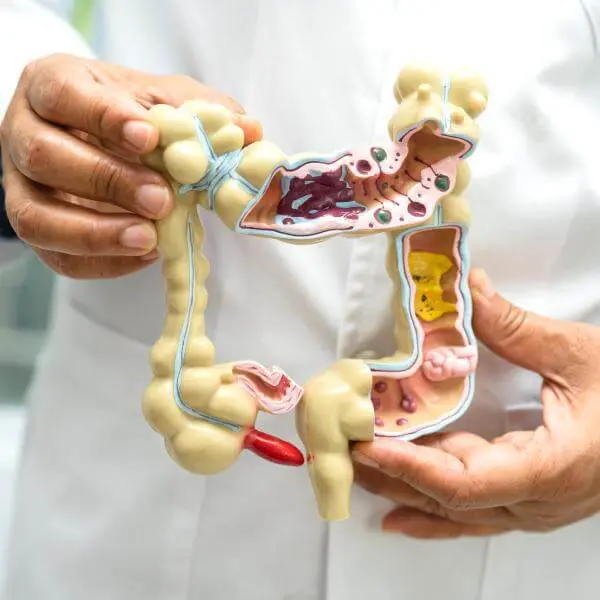 Un médecin tient un modèle anatomique en plastique expliquant pourquoi mettre l'intestin au repos.